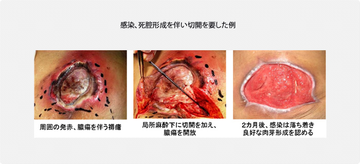 創部局所環境の整備：TIMEという概念