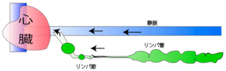 リンパ浮腫の模式図