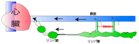 リンパ管静脈吻合を行った際の模式図